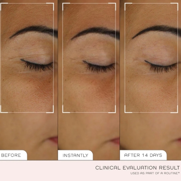 NIB REN CLEAN SKINCARE SMOOTH PREP & PLUMP ESSENCE - Picture 8 of 14